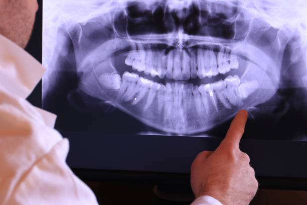 Best Emergency Dentist for Special Needs Patients in Wyong, MI